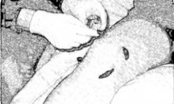 259 194 LEECH SKETCH